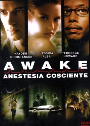 Awake-Anestesia Cosciente DVD in Italiano Versione Noleggio